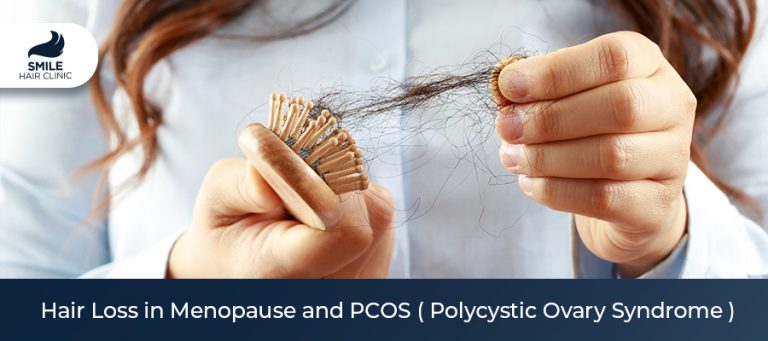 Hair Loss in Menopause and PCOS ( Polycystic Ovary Syndrome )