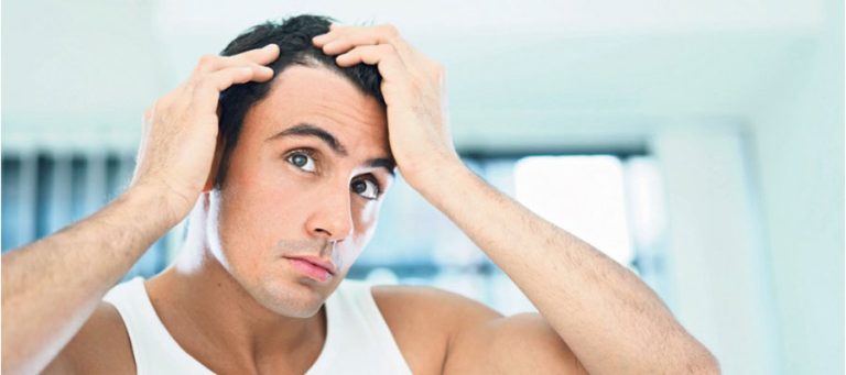 מהי השתלה בהשתלת שיער?