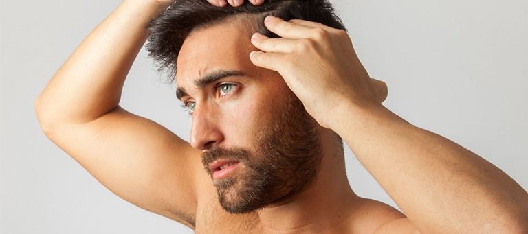 la Meilleure Greffe de Cheveux