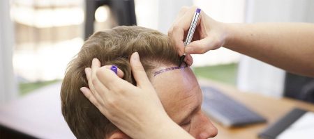 sac-ekimi-sonrasi-sac-yikama