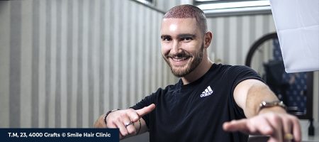 BEST HAIR TRANSPLANT IN THE WORLD 01