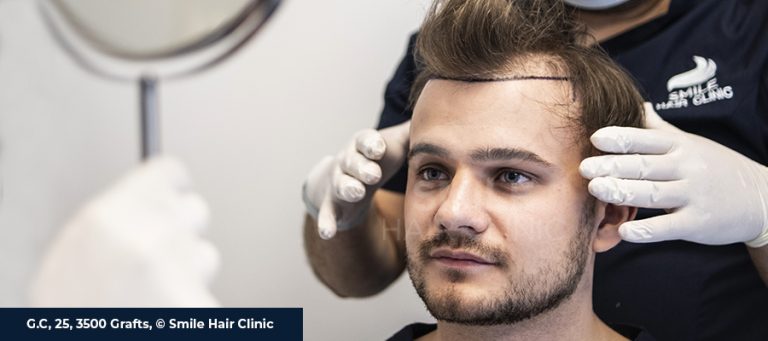 hair transplant cost USA