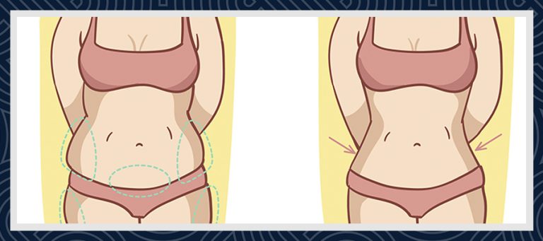 Gastric Sleeve Turkiet