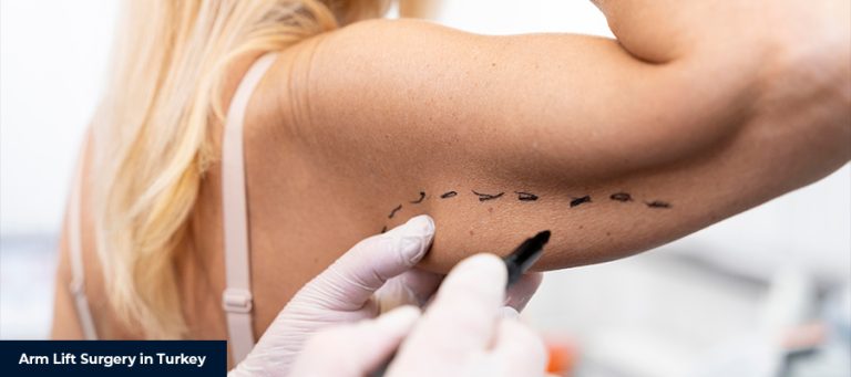 Armlyftskirurgi i Turkiet