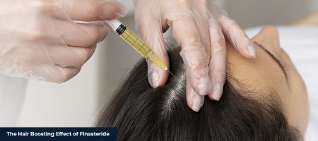 Hair Boosting Effect of Finasteride 1