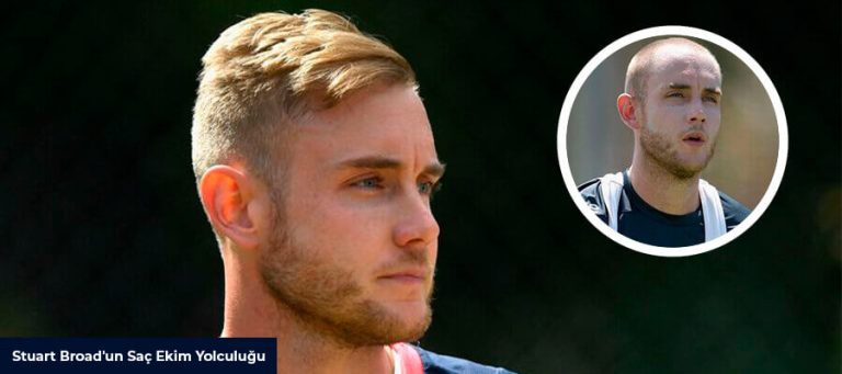 Stuart Broad’un Saç Ekim Yolculuğu