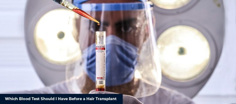 Which Blood Test Should I Have Before a Hair Transplant