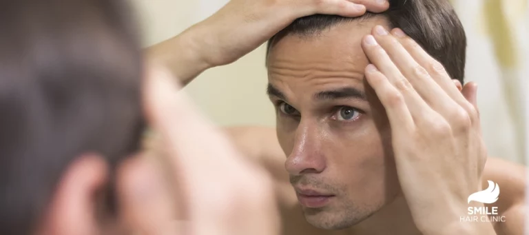 Antidepresants Cause Hair Loss