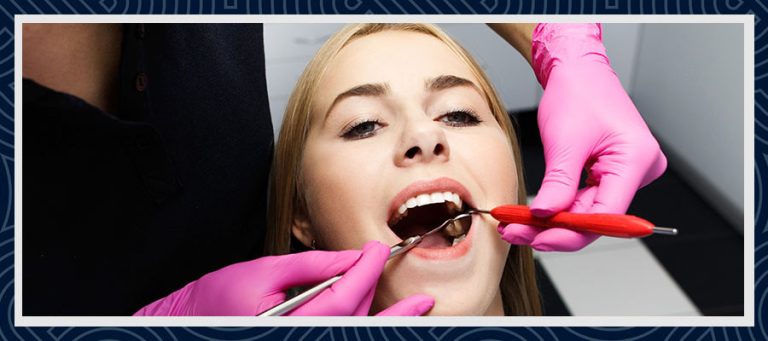 Dental Bonding i Turkiet