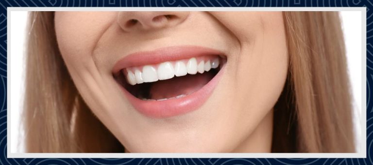 Hollywood Smile Turkiet