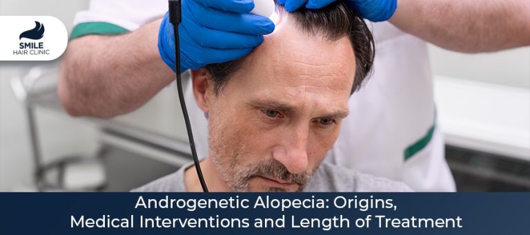 Androgenetic Alopecia