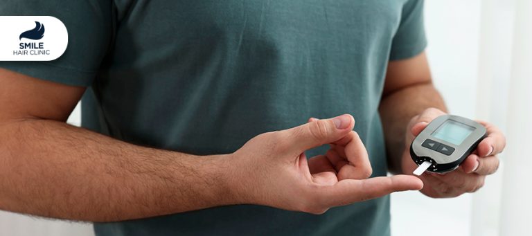 האם חולי סוכרת יכולים לעבור השתלת שיער?
