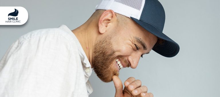 מתי אני יכול לחבוש כובע לאחר השתלת שיער?