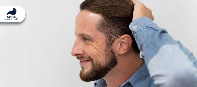 ¿Las Pelucas Causan Pérdida De Cabello?