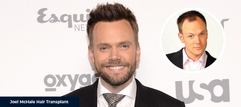 La Greffe de Cheveux de Joel McHale