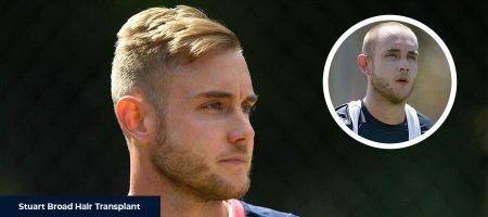 Stuart-Broad-Before-After