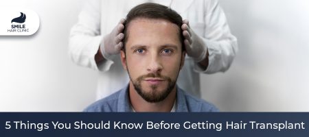 5-Things-You-Should-Know-Before-Getting-Hair-Transplant