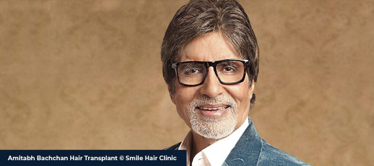 Amitabh Bachchan Hair Transplant