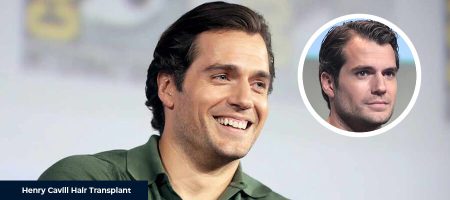 Before-After-Henry-Cavill