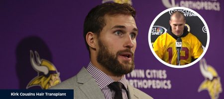 Before-After-Kirk-Cousins-1