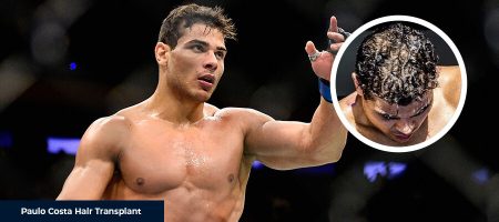 Before-After-Paulo-Costa