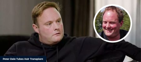 Before-After-Peter-Dale-Tubes