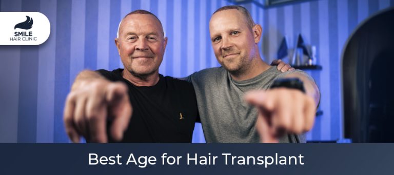 At What Age Should You Get a Hair Transplant?