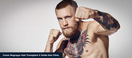 Conor-Mcgregor-Hair-Transplant-01