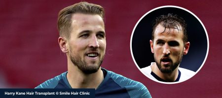 Harry-Kane-Header