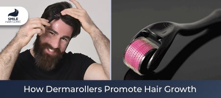 How-Dermarollers-Promote-Hair-Growth