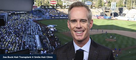 Joe-Buck-Hair-Transplant-01