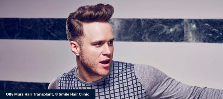 Olly Murs hårtransplantation