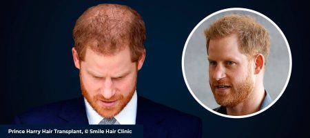 Prince-Harry-03-Header-1