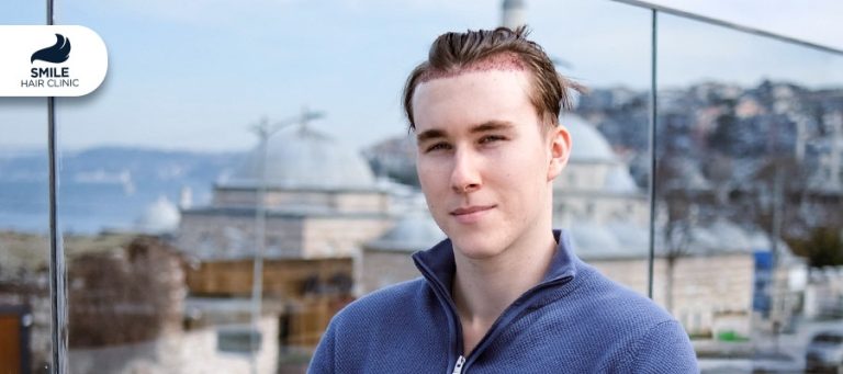 The Global Capital of  Hair Implants