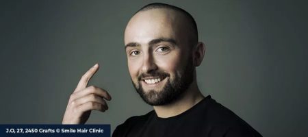 Why-To-Choose-Smile-Hair-Clinic