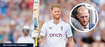 before-after-ben-stokes
