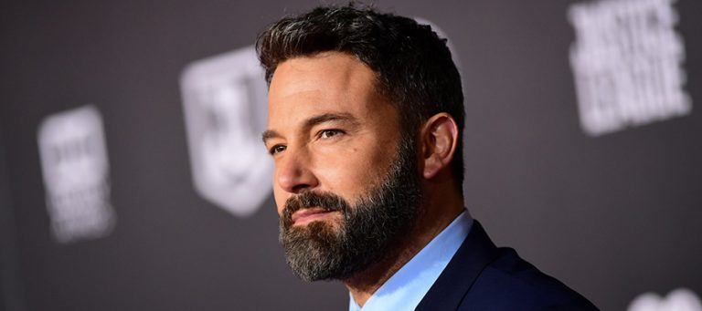 השתלת השיער של בן אפלק