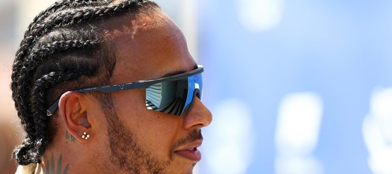 השתלת השיער של לואיס המילטון