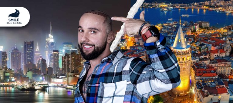 Hair Transplant in Los Angeles