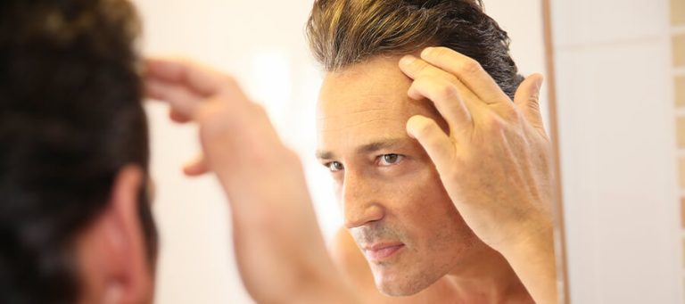 セレブのヘア移植