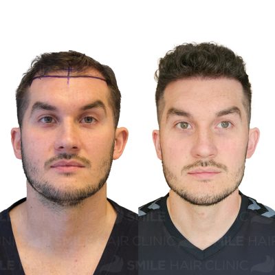 3850 Grafts - FILIP CIBOR