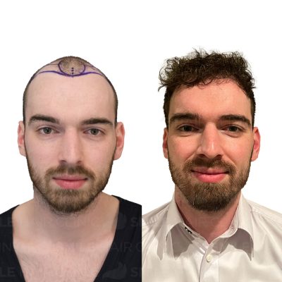 4000 gRAFTS - GERT VAN DE KOLK