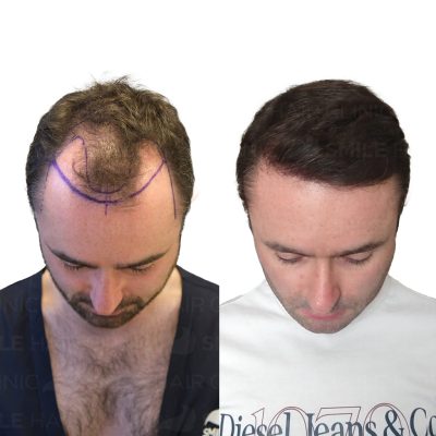 4150 Grafts - LIAM EGAN