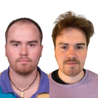 4300 Grafts - ODIN JEAN AADLAND