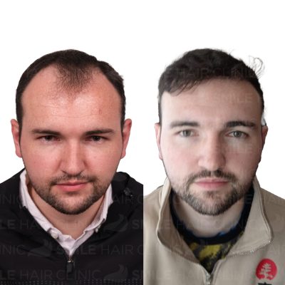 4600 Grafts - SEAN KENNNELLY