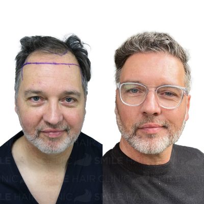 4750 Grafts - CLIVE VANDERWAGEN