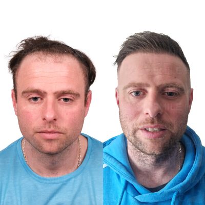 4750 Grafts - WILLIAM COCHRANE