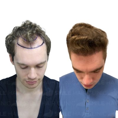 4800 Grafts - MORTEN BJORKAAS