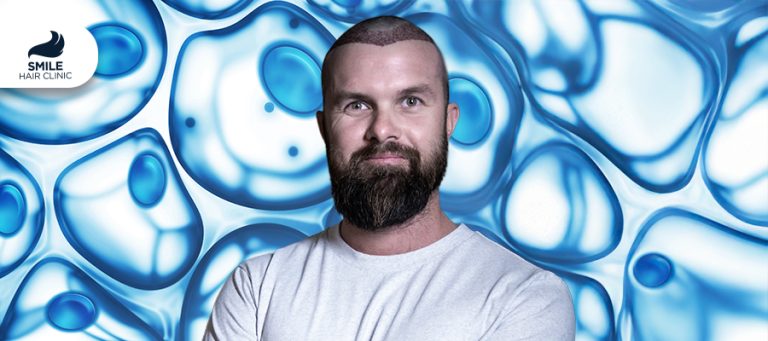 What is Exosome Therapy for Hair Loss?