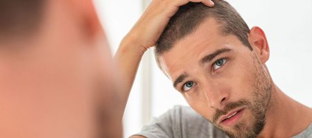 erkek-tipi-saç-dmkülmesi